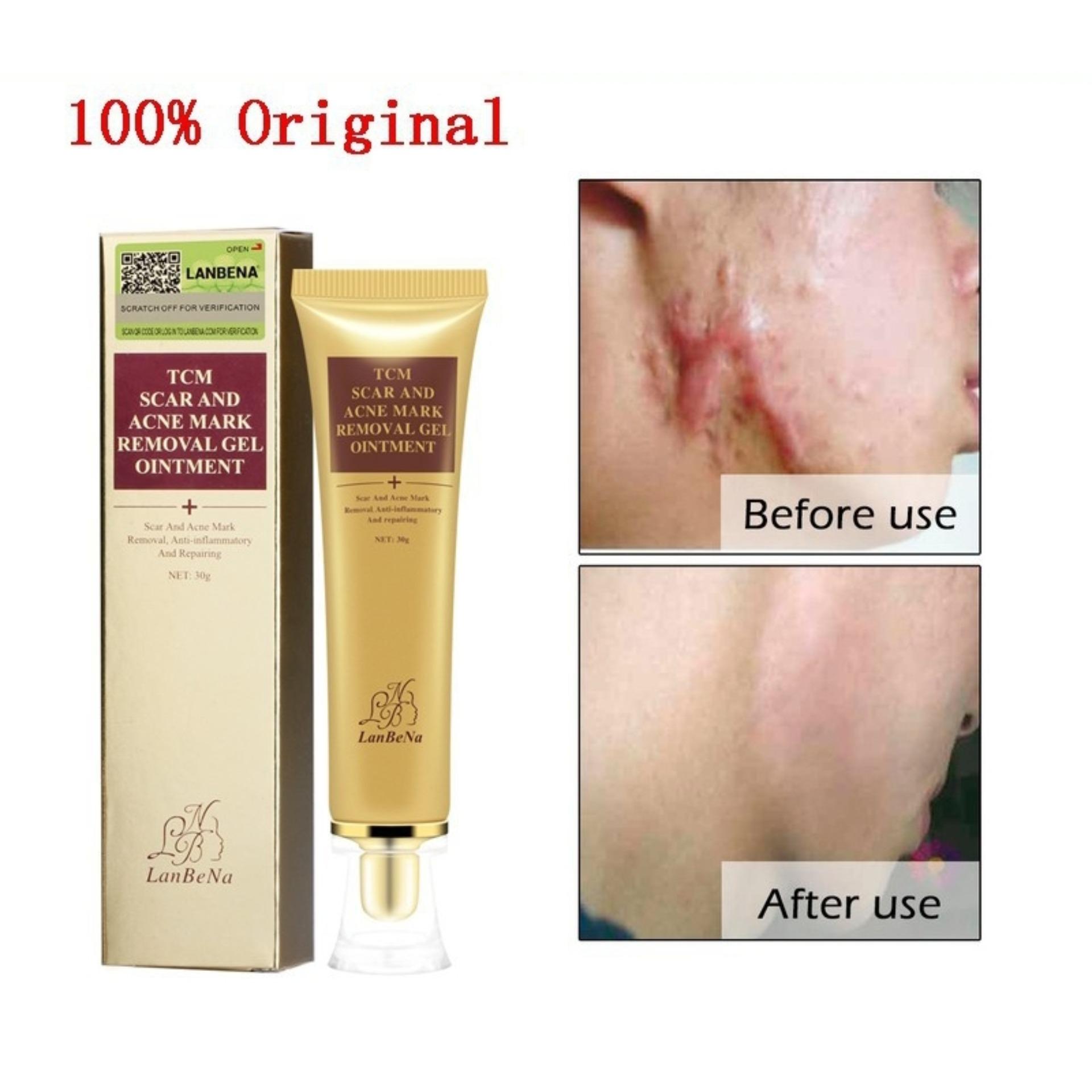 Please recommend some kind of ointment effective from radiculitis 95 Please recommend some kind of ointment effective from radiculitis 7