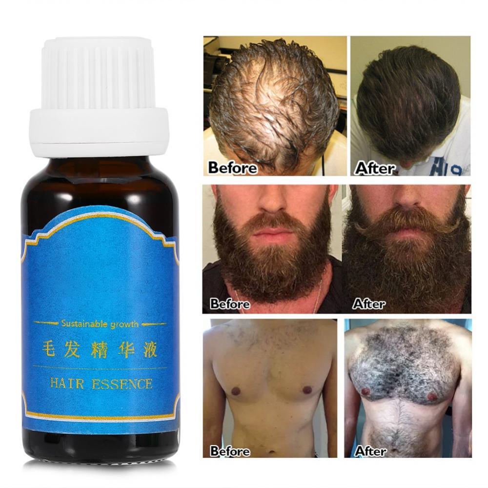 20ml Growth Essence Beard Sideburns Eyebrows Eyelashes Body Hair