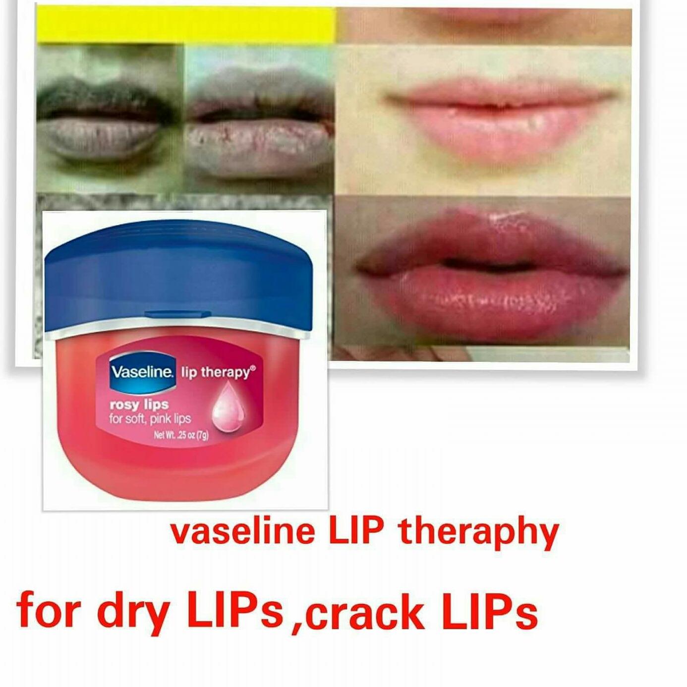 Vaseline lip therapy, moisturizing gel,soft pinkish lips Philippines