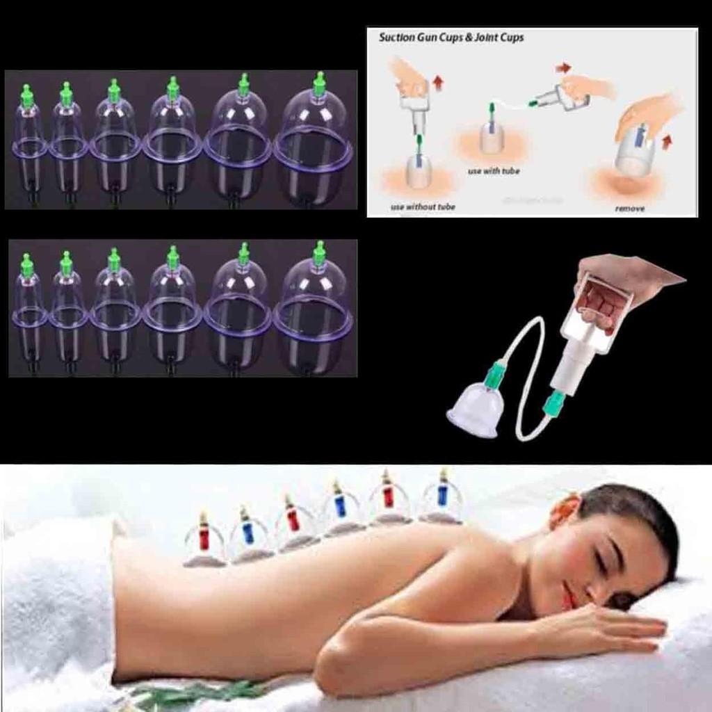 Pull Out Vacuum Apparatus Traditional Ventosa Self Treatment at Home 12pcs