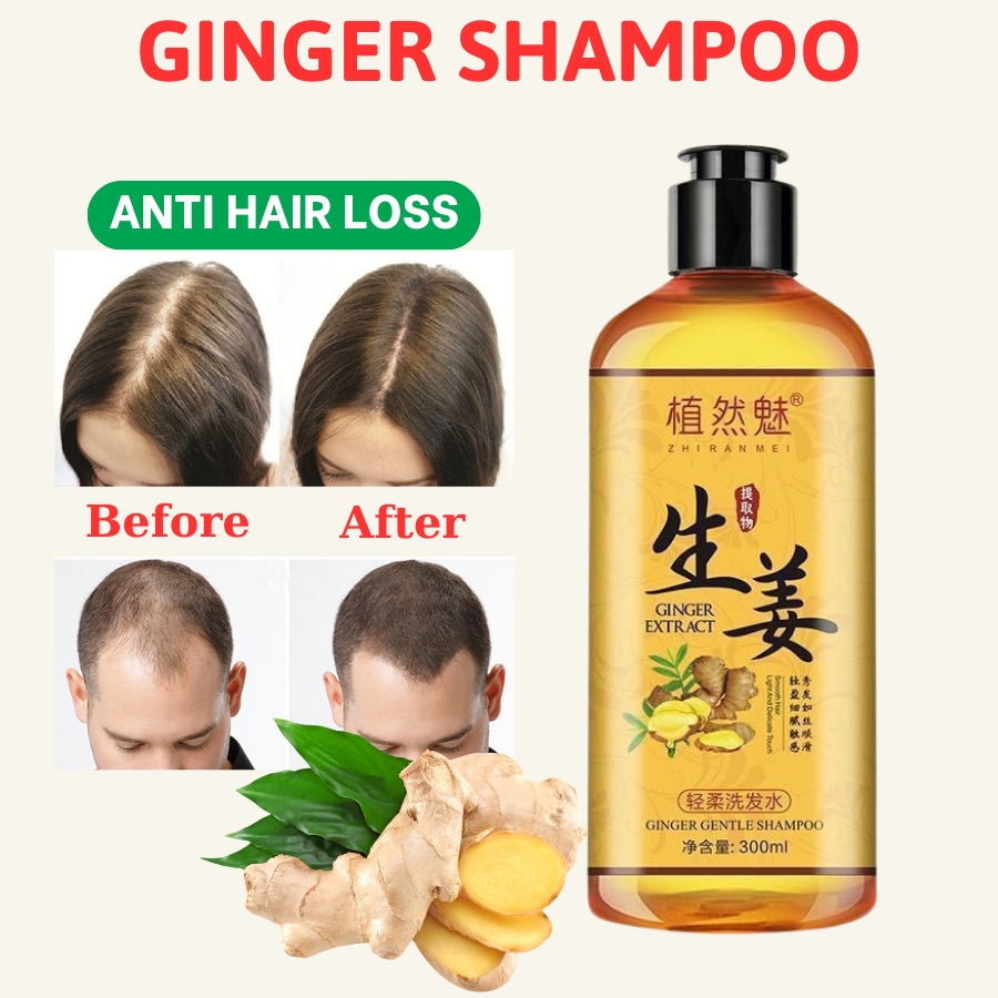 Ginger Hair Growth Shampoo - Anti-Dandruff & Nourishing Treatment 300ml