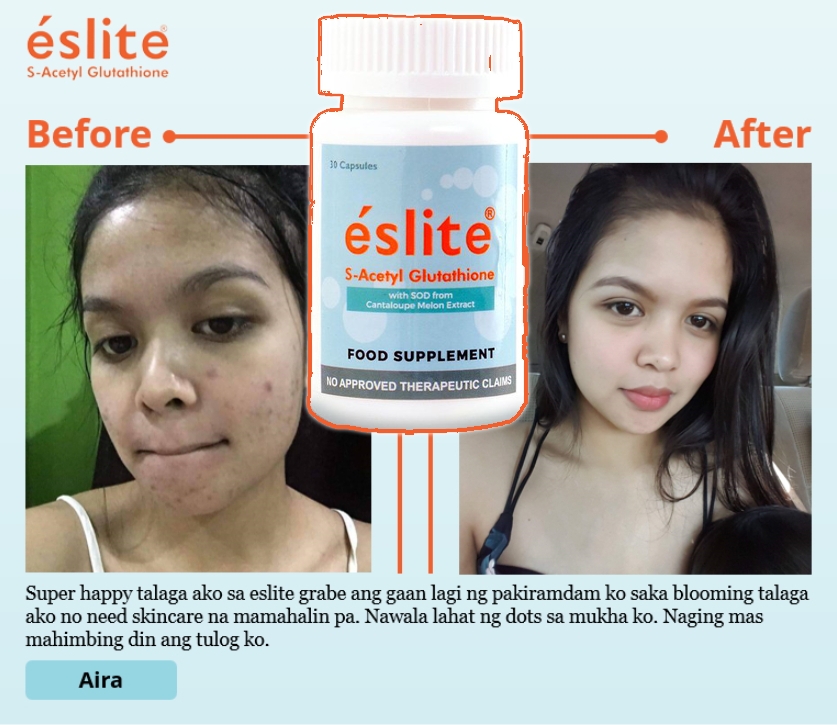 eslite sacetyl glutathione review S-Acetyl 60 Capsules BSN Energy & Performance