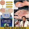 BaiXuanGao Skin Treatment Cream - Herbal Antibacterial and Antifungal