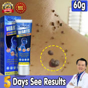 7-Day Results Warts Remover Cream by Warts Magic