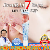 Sumifun Acne Repair Cream - Effective Pimple Marks Remover