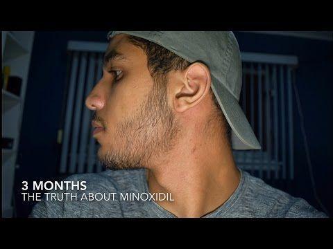 Kirkland Signature Hair Regrowth Treatment Minoxidil Foam For Men
