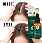 Ginger Hair Grower Serum - Fast, Natural Hair Treatment