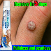 Sumifun Wart Removal Cream - Removes Warts Naturally in 5 Days