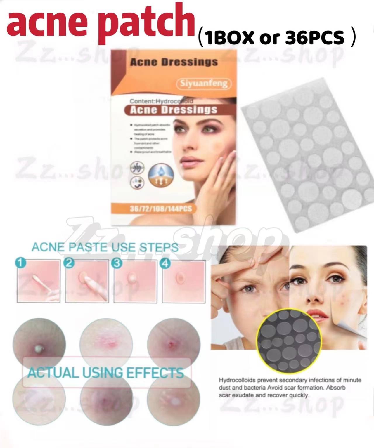 Shop G21 Pimple Patches with great discounts and prices online - Aug 2022 |  Lazada Philippines