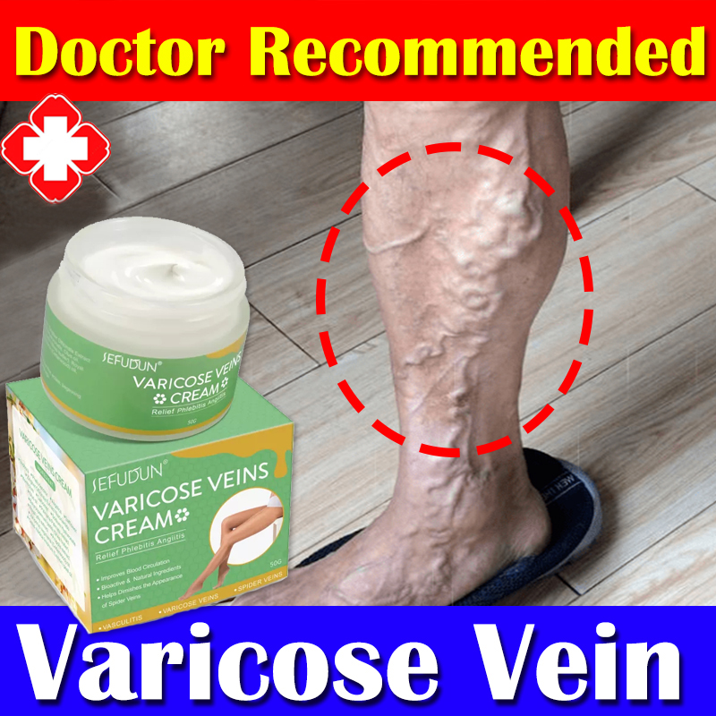 Pack Varicose Veins Miracle Treatment Cream Leg Vasculitis Phlebitis
