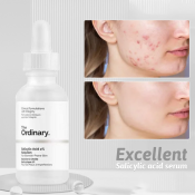 The Ordinary Salicylic Acid Serum: Acne-Fighting Exfoliating Solution