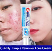 Acne Repair Cream with Aloe Vera - Bye Scar