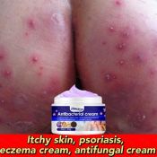 Atoderma Quick Relief Cream for Itchy Skin - 30g