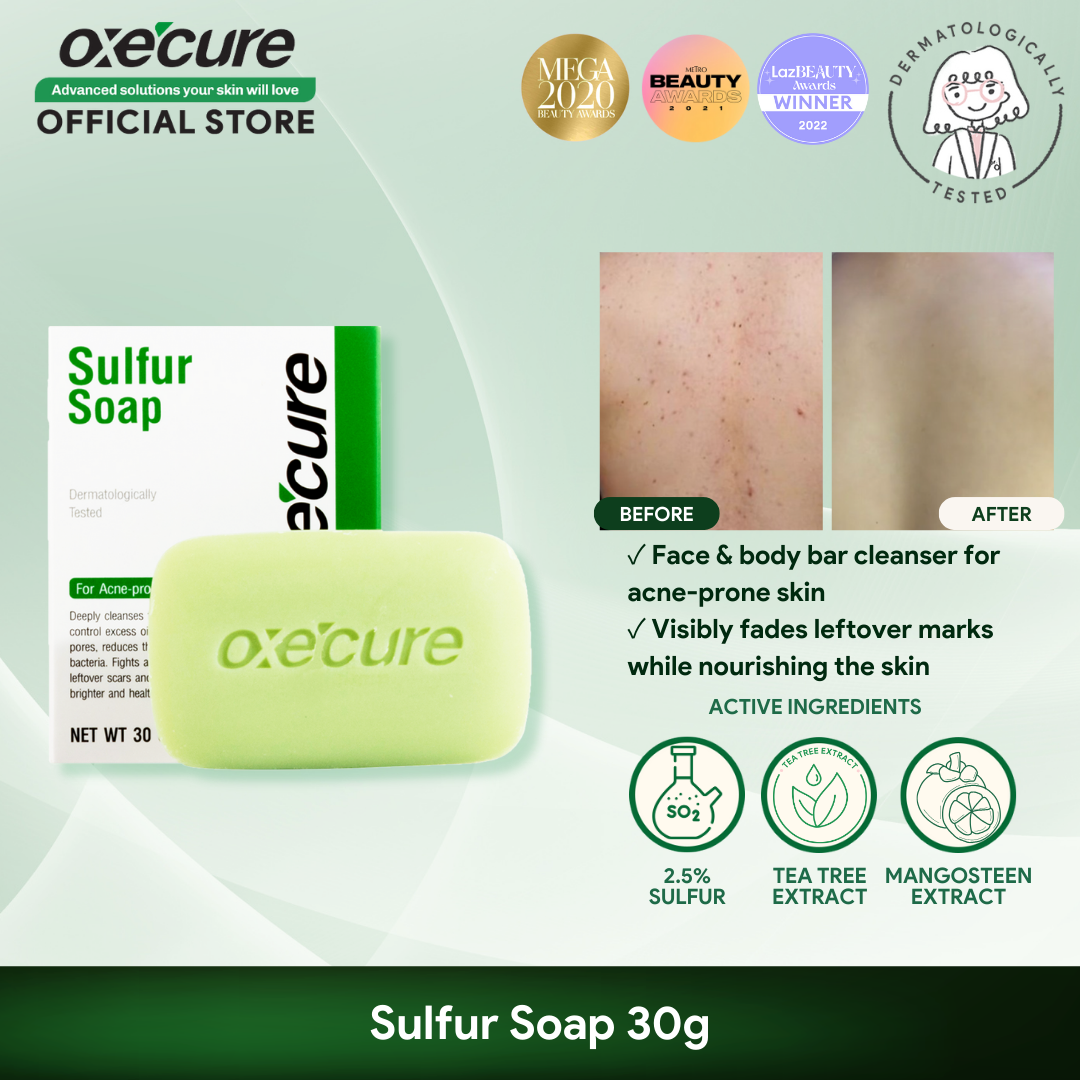 磊 Top 10 Best Sulfur Soaps of 2023