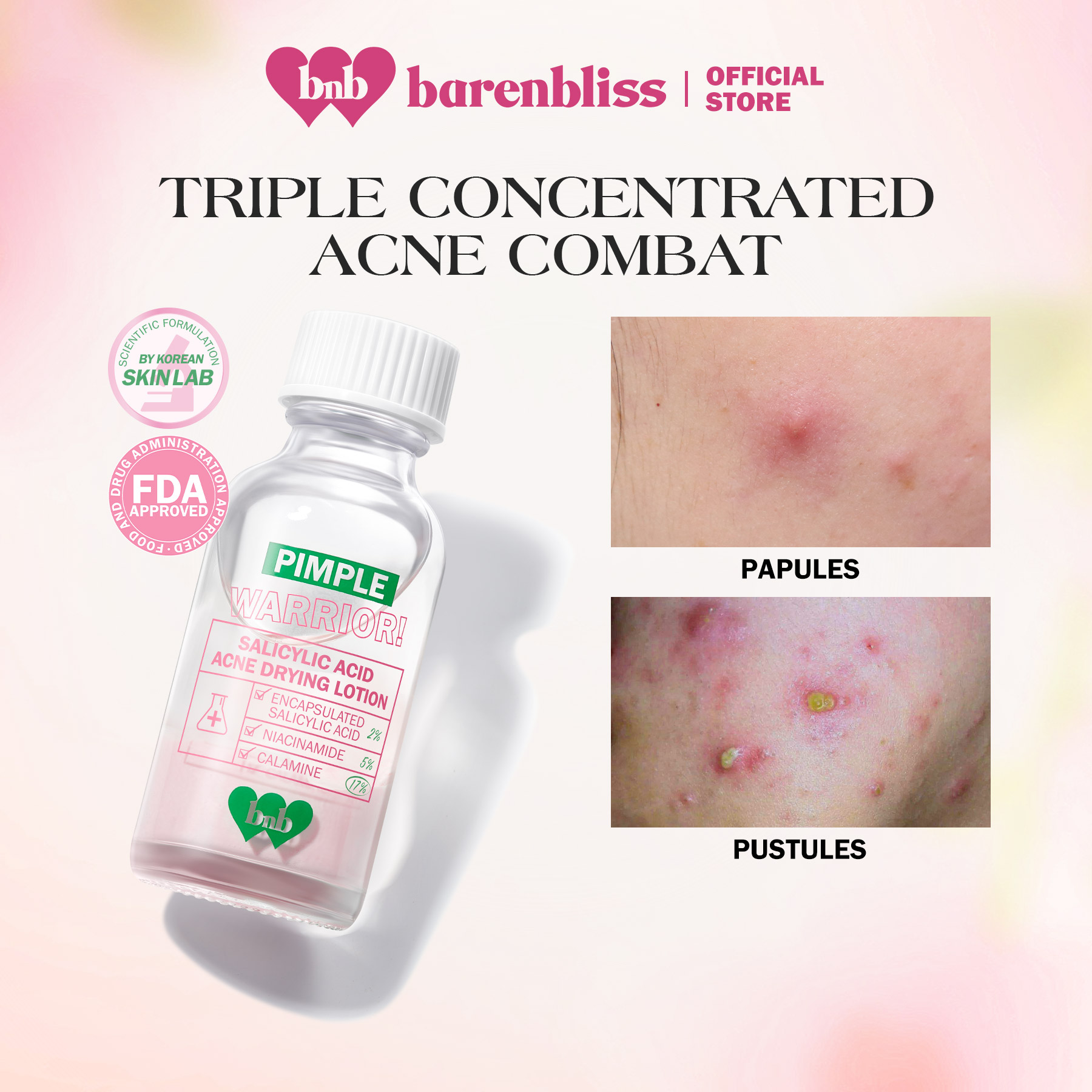 Shop Salicylic Acid For Warts Cream online | Lazada.com.ph