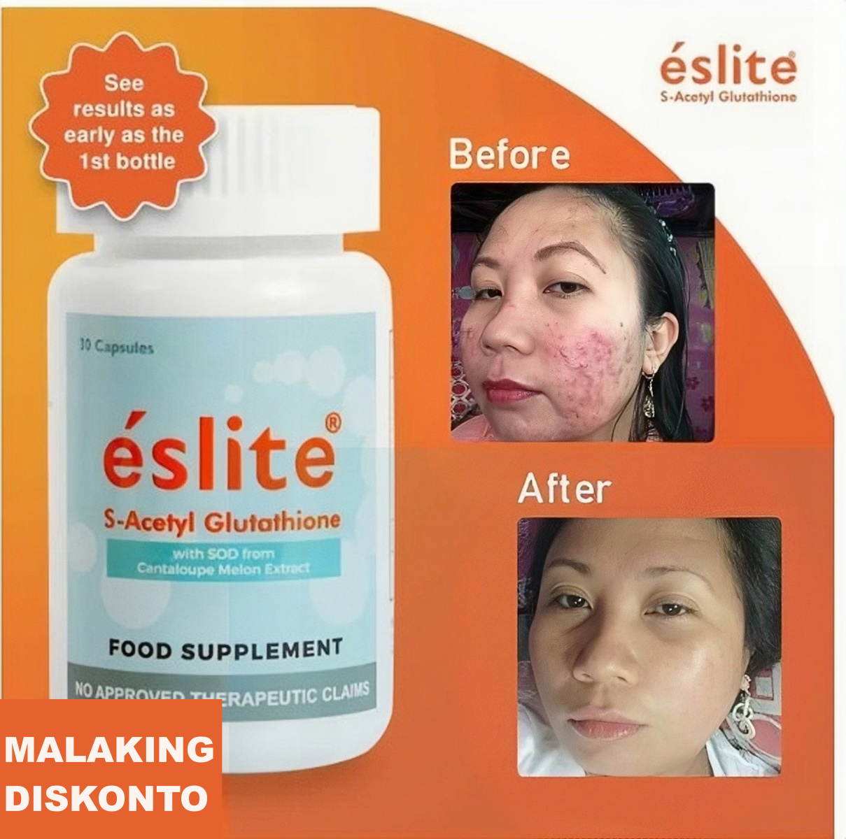 Get Eslite Glutathione Capsul at the Best Prices Online