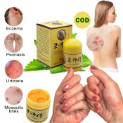 Chinese Herbs Eczema Psoriasis Cream for Allergy Itchy Skin