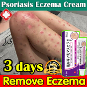 "Fast-acting Eczema & Psoriasis Cream from Japan"
