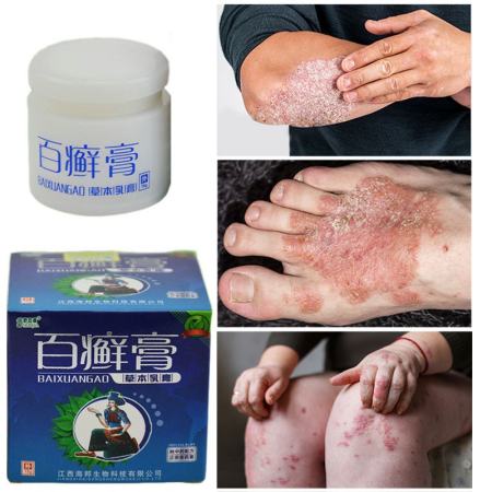 BaiXuanGao Herbal Antibacterial Cream for Itchy Skin Allergy