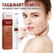WipeOff Tags Moles Remover - Painless Warts & Skin Tags Remover