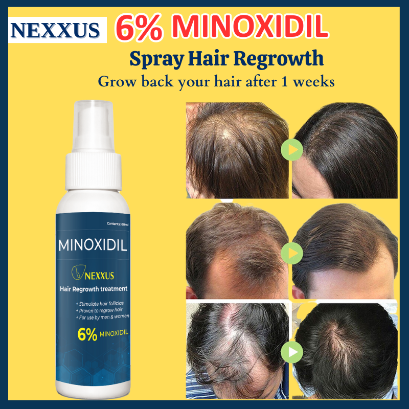 Bosley MD Men's Regrowth Treatment 5% Minoxidil Spray - Walmart.com