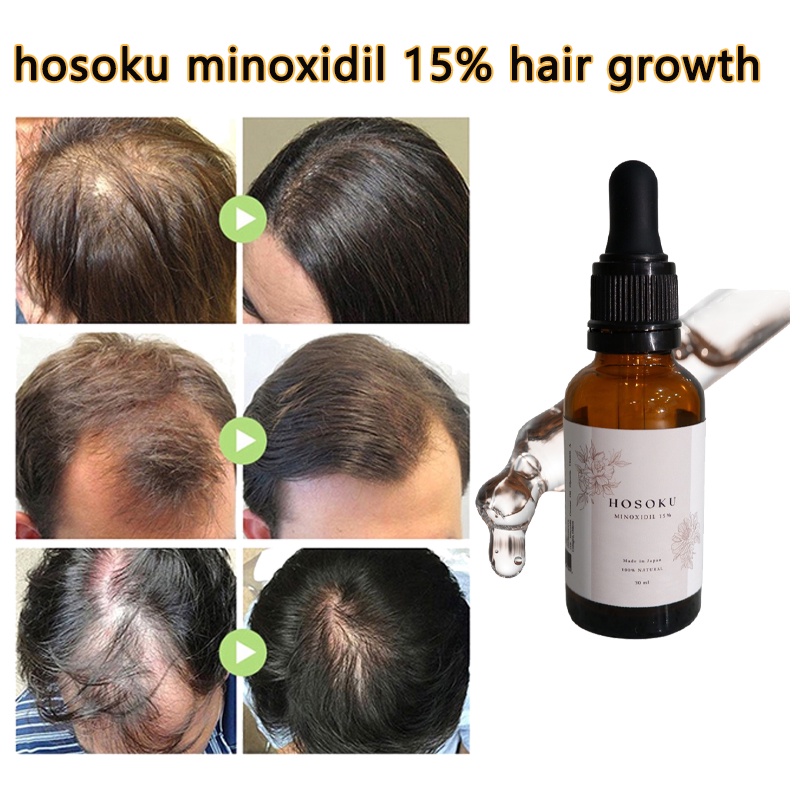HOSOKU MINOXIDIL 15% ORIGINAL Hair Growth Hosoku Hair Growth Serum