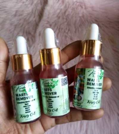 Kasoy Oil Warts Mole Remover by 