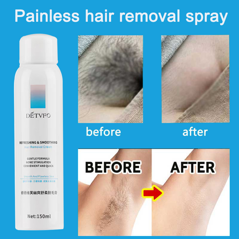 Aggregate more than 143 detvfo hair removal spray ceg.edu.vn