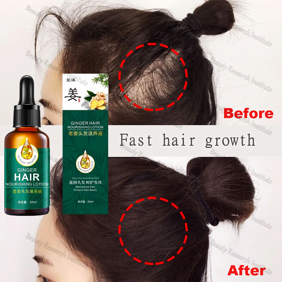 Natural ginger Hair Serum Hair Grower Fast Long Hair Hair Treatment For Hair  Growth Spray Essence Hair Loss Treatment | Lazada PH