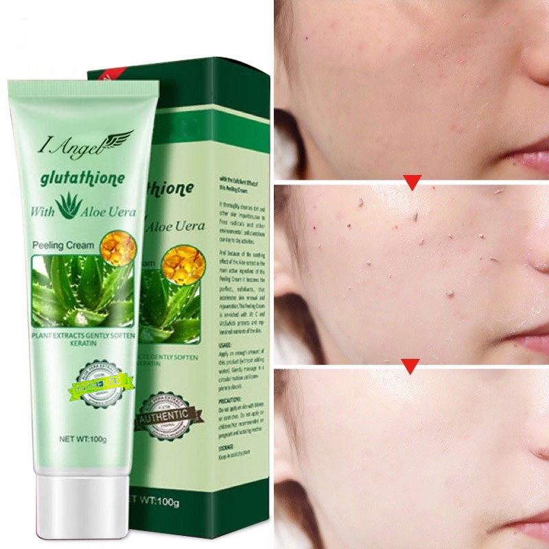 I Angel Glutathione with Aloe Vera Magic Peeling Cream Exfoliate 100g