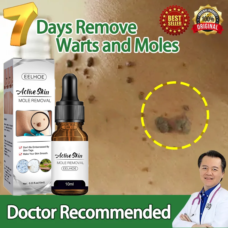 Shop Miracle Organic Mole Remover with great discounts and prices