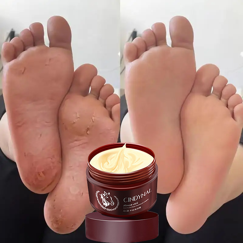 Horse Oil Hand Foot Cream Horse Anti-Chafing Skin Repairing Moisturizer for  Rough Dry and Cracked Chapped Feet Heel Anti-Aging Horse Oil Dry Skin Care  Moisturizing Whitening Cream Crack Heel Remover Cream Original