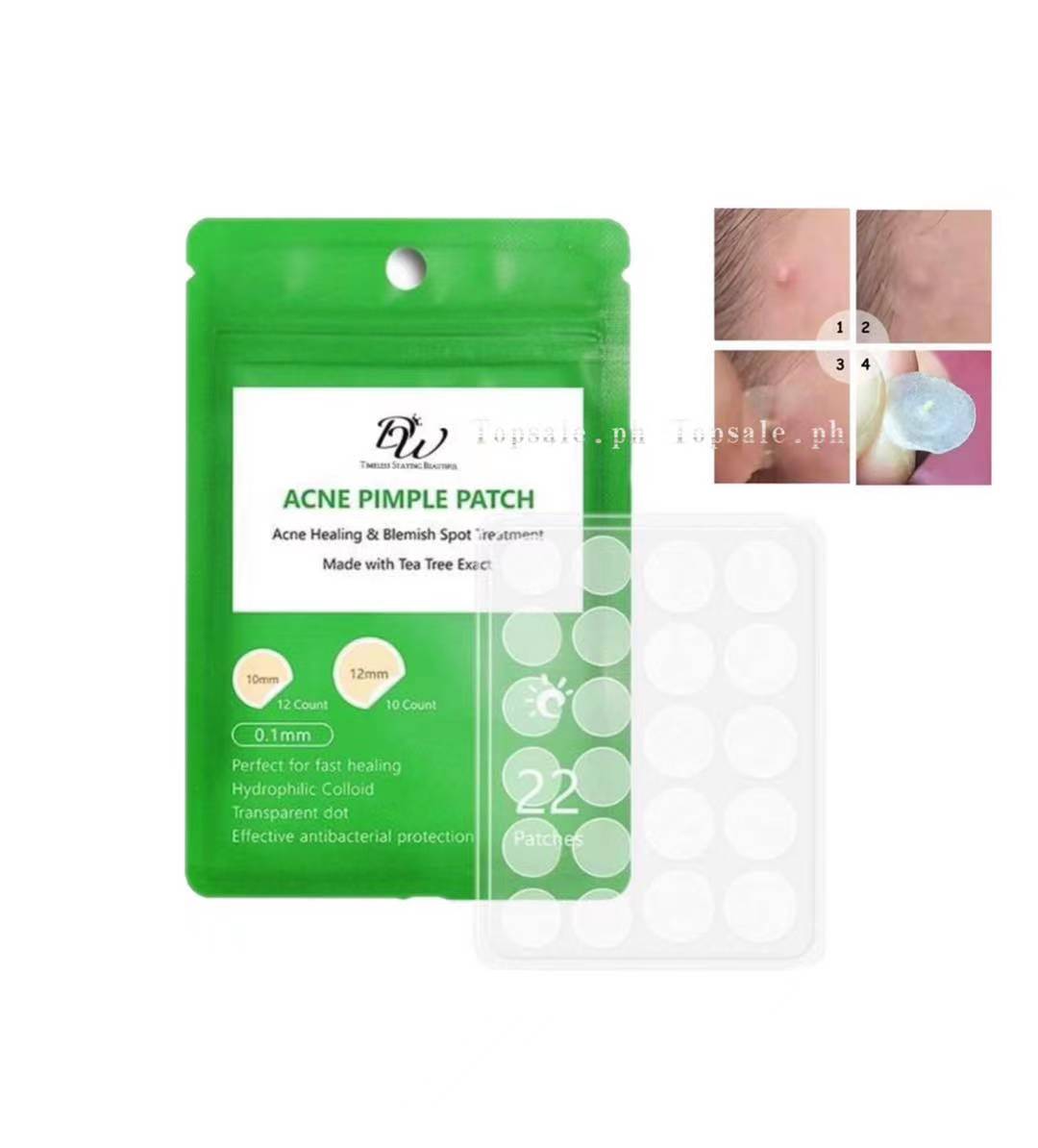 Shop G21 Pimple Patches with great discounts and prices online - Aug 2022 |  Lazada Philippines