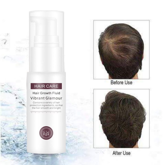 VIBRANT GLAMOUR Natural Hair Growth Essence Spray Prevent Baldness Consolidate Prevent Hair Loss Nourish Hair Roots VIBRANT GLAMOUR Natural Hair Growth Essence Spray Prevent Baldness Consolidate Prevent Hair Loss Nourish Hair Roots
