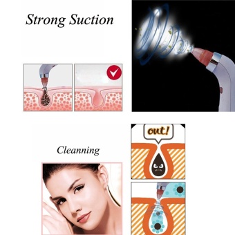 2017 New Blackhead Removal Machine 4 In 1 Diamond DermabrasionRemoval Scar Acne Pore Peeling Face Clean Vaccum Beauty Tool - Intl June 2018 - 4 2017 New Blackhead Removal Machine 4 In 1 Diamond DermabrasionRemoval Scar Acne Pore Peeling Face Clean Vaccum Beauty Tool - intl - 4