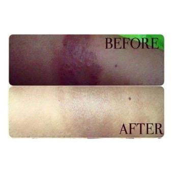 Bare Body Premium Rosehip Oil (15ml) Bundle Of 2 June 2018 - 5 Bare Body Premium Rosehip Oil (15ml) Bundle of 2 - 5