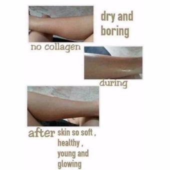 Collagen & Glutathione Perfect Magic Peeling Cream June 2018 - 3 Collagen & Glutathione perfect magic peeling cream - 3