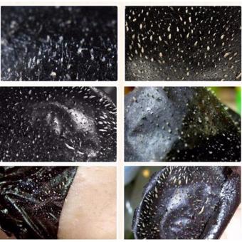 DIY Facial Blackheads Whiteheads & Dry Pimple Remover By Doctor Li June 2018 - 2 DIY Facial Blackheads Whiteheads & Dry Pimple Remover by Doctor Li - 2