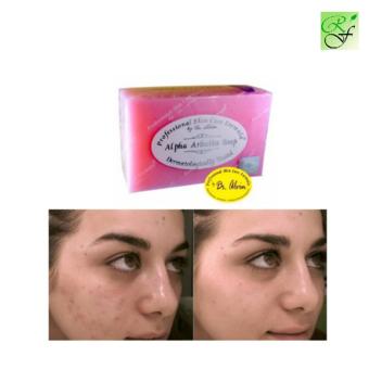 Dr. Alvin Alpha Arbutin Whitening Soap June 2018 - 2 Dr. Alvin Alpha Arbutin Whitening Soap - 2