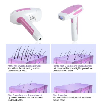 Electric HPL Hair Removal Machine System Permanent Body Epilator With 2 Lamps Blue - Intl April 2018 - 2 Electric HPL Hair Removal Machine System Permanent Body Epilator with 2 Lamps Blue - intl - 2