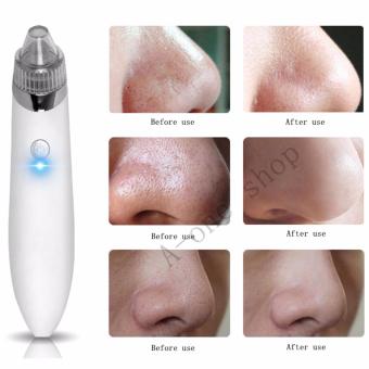Electric Pore Cleaner Acne Blackhead Remover Skin Care Device PoreVacuum Extraction USB Rechargeable Comedo Suction Tool(RoseGold/White) June 2018 - 4 Electric Pore Cleaner Acne Blackhead Remover Skin Care Device PoreVacuum Extraction USB Rechargeable Comedo Suction Tool(RoseGold/White) - 4