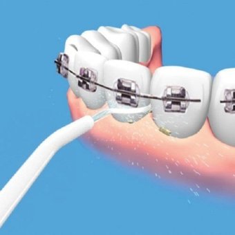 Power Whitening Flosser Oral Irrigator Electric Floss Pick DentalCare Water Jet Cords Tooth, Pick Braces - INTL June 2018 - 2 Power Whitening Flosser Oral Irrigator Electric Floss Pick DentalCare Water Jet Cords Tooth, Pick Braces - INTL - 2