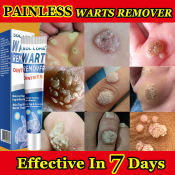 💖Safe & Painless Warts Remover Cream - Skin Growth Removal