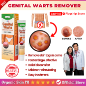 Genital Warts Remover Cream: Whitening, Treatment, Psoriasis Relief, Skin Tag
