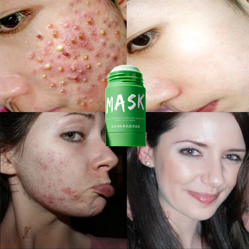 Share 156+ used tea bags for skin 3tdesign.edu.vn