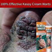 Kasoy Cream: Effective Warts Remover for Skin Tags and Moles