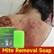 Herble Skin Repair Soap for Eczema and Acne