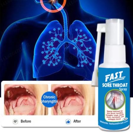 Rapid Relief Sore Throat Spray (Brand Name Unavailable)