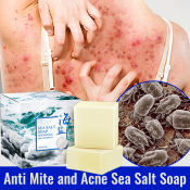 Sea Salt Acne Treatment Soap by BrandName