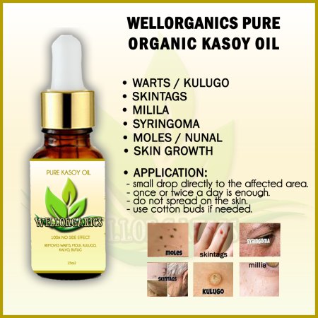 WELLORGANICS Kasoy Oil: Organic Warts Remover for Skintags & Mo